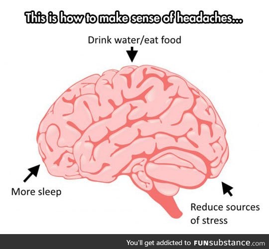Sources of headaches