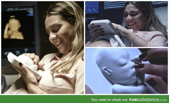 3D printed ultrasound for blind expectant mother