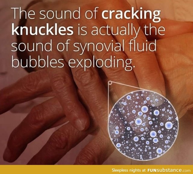 This is the cause of popping in your knuckles