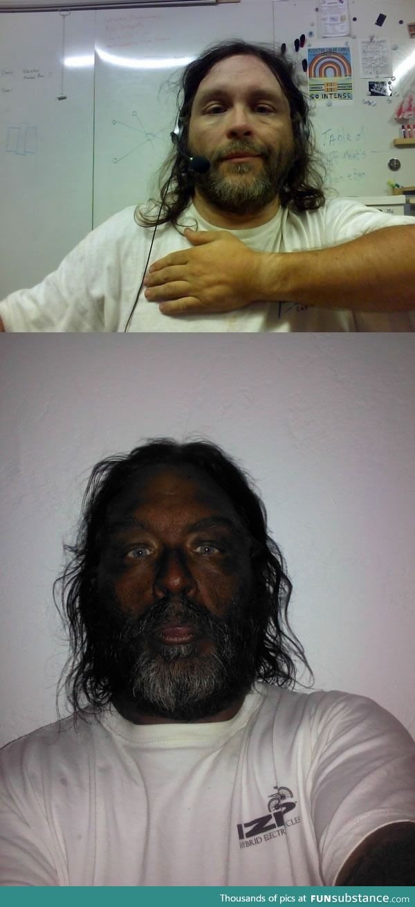 Before and after photos of a man injecting himself with Melanotan II