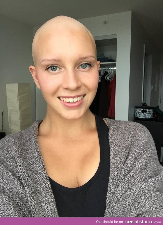"After months of hanging onto my thinning hair, I finally let go and shaved my head"