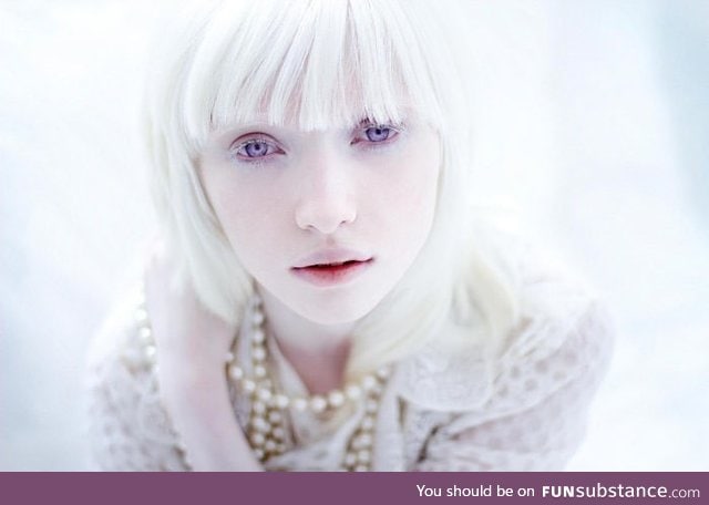 An Albino model: Nastya Zhidkova