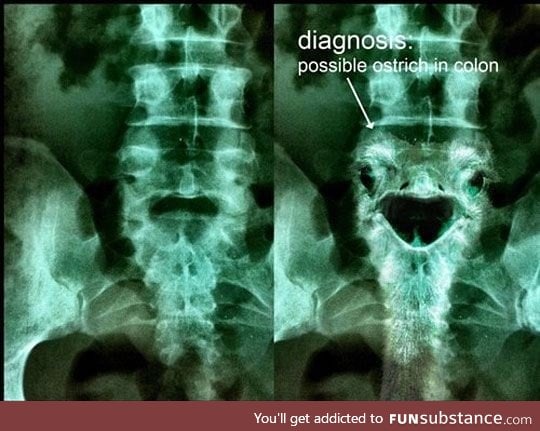 The diagnosis