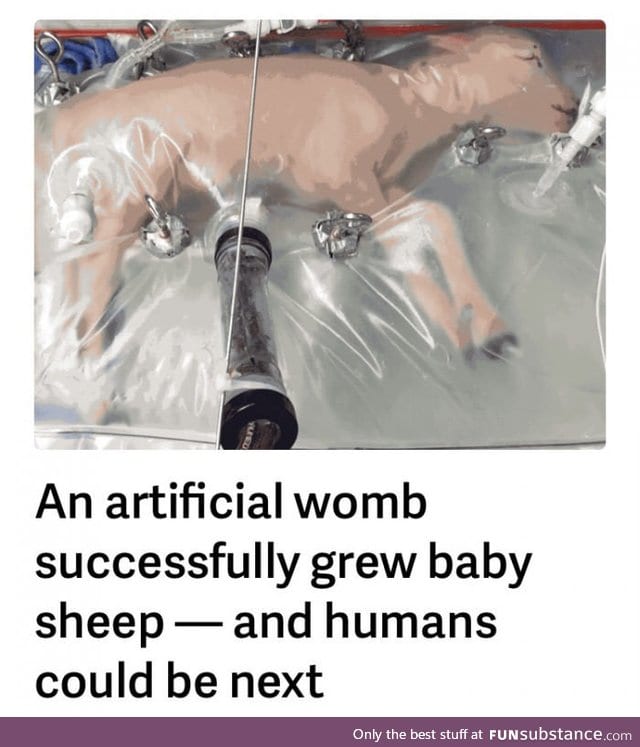 Artificial wombs