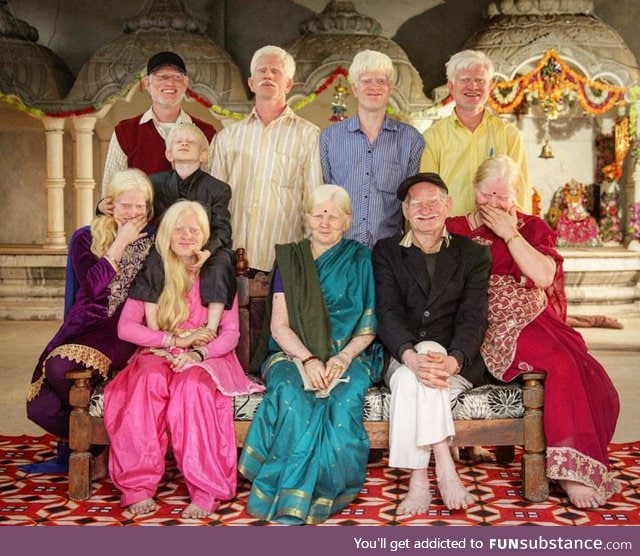 Three generations of an albino family in India