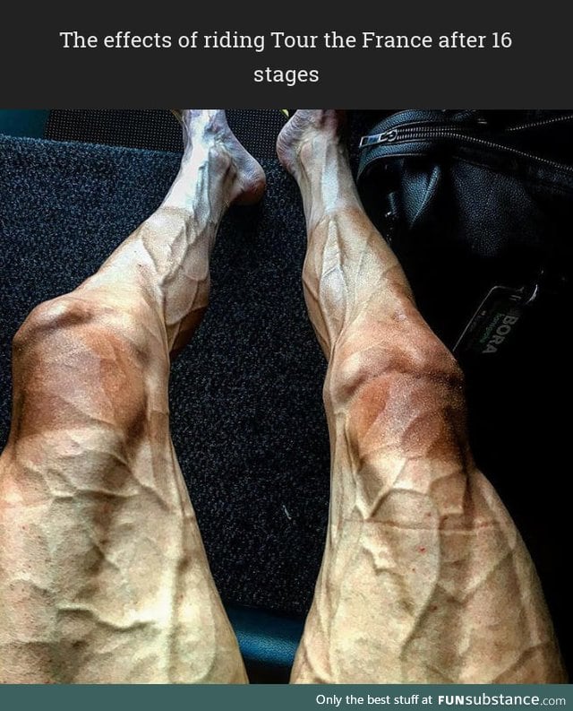 This is what Tour the France rider legs look like after 16 stages