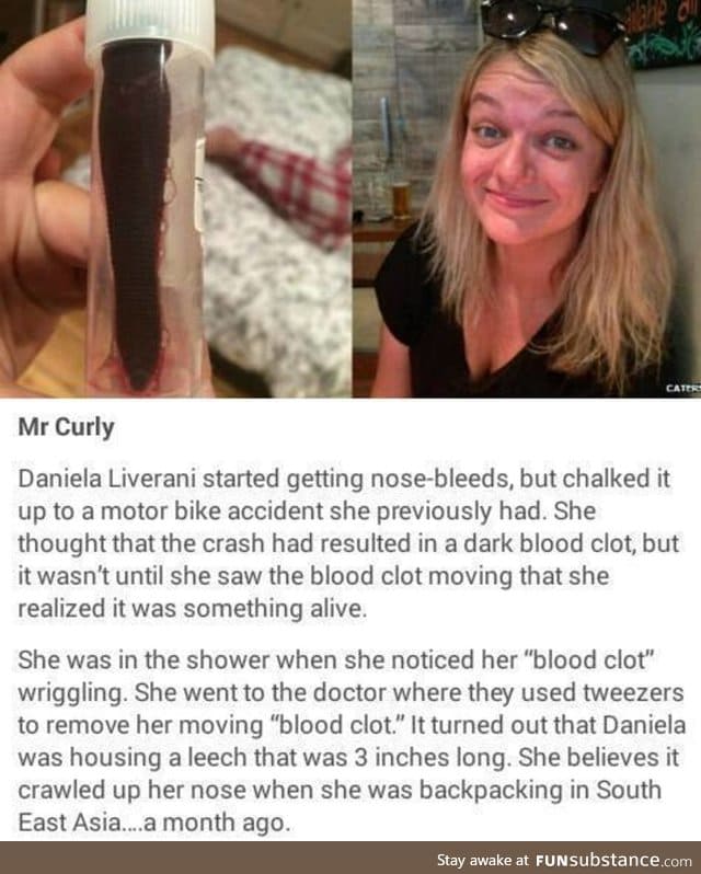 Daniela discovered her blood clot was actually a monster