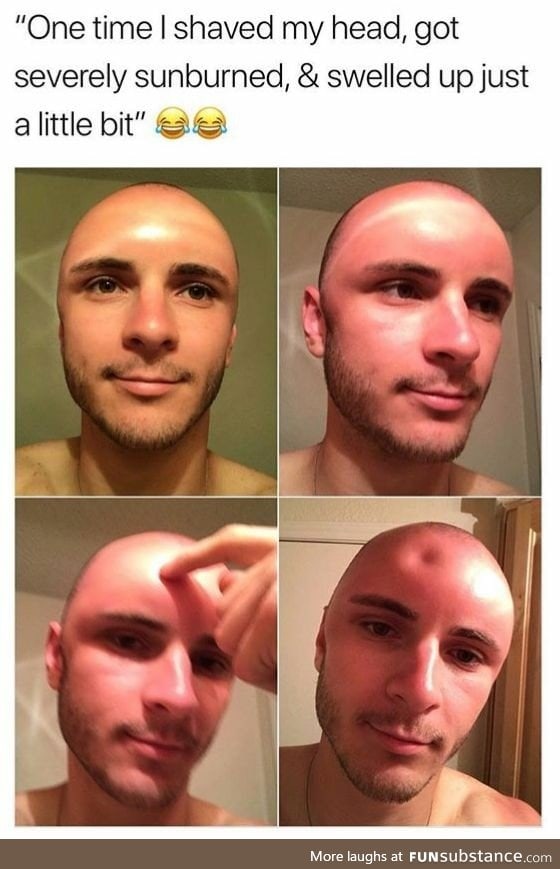 Don't shave your heads, kids