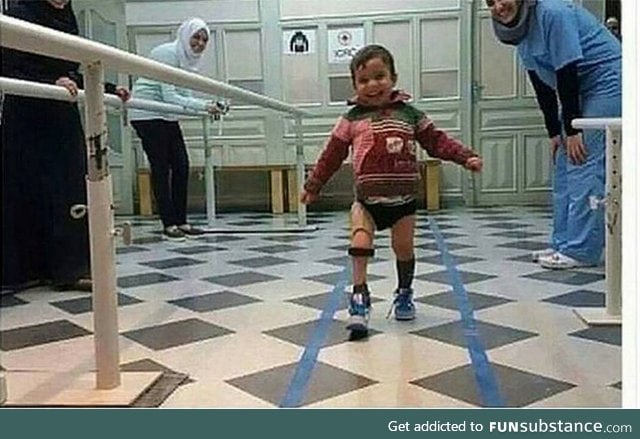 A Syrian kid after receiving a synthetic leg