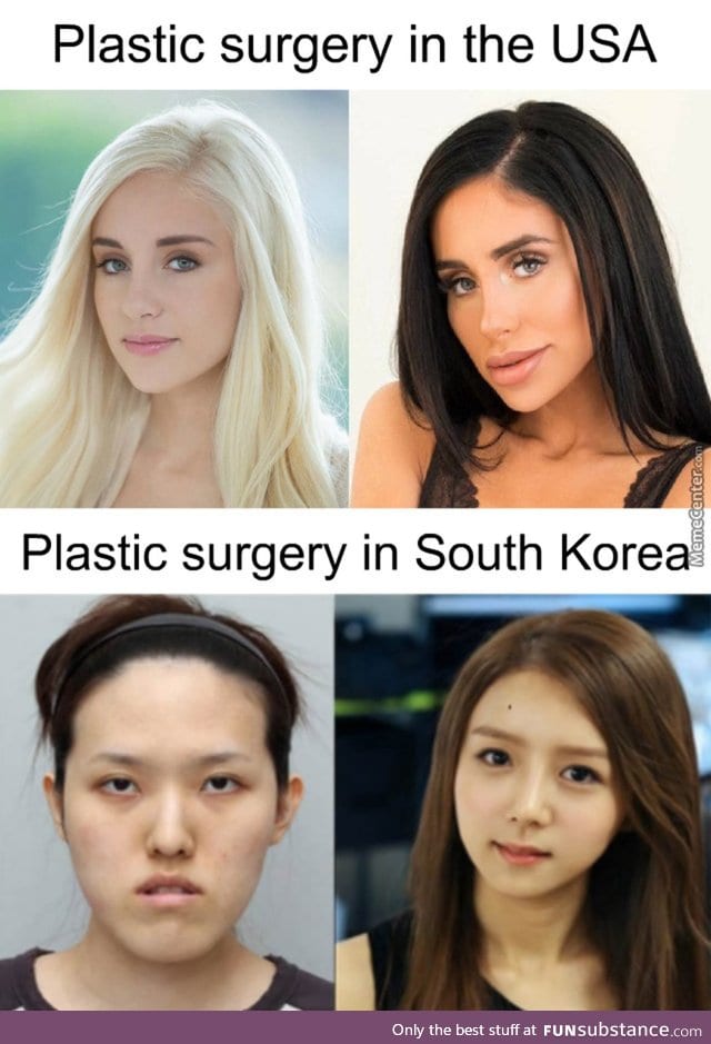 Plaster surgery in USA vs Korea