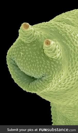 A microscopic photo of a Protozoa