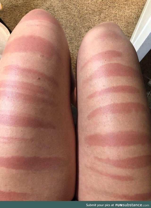 Legs after a day in the sun in ripped jeans