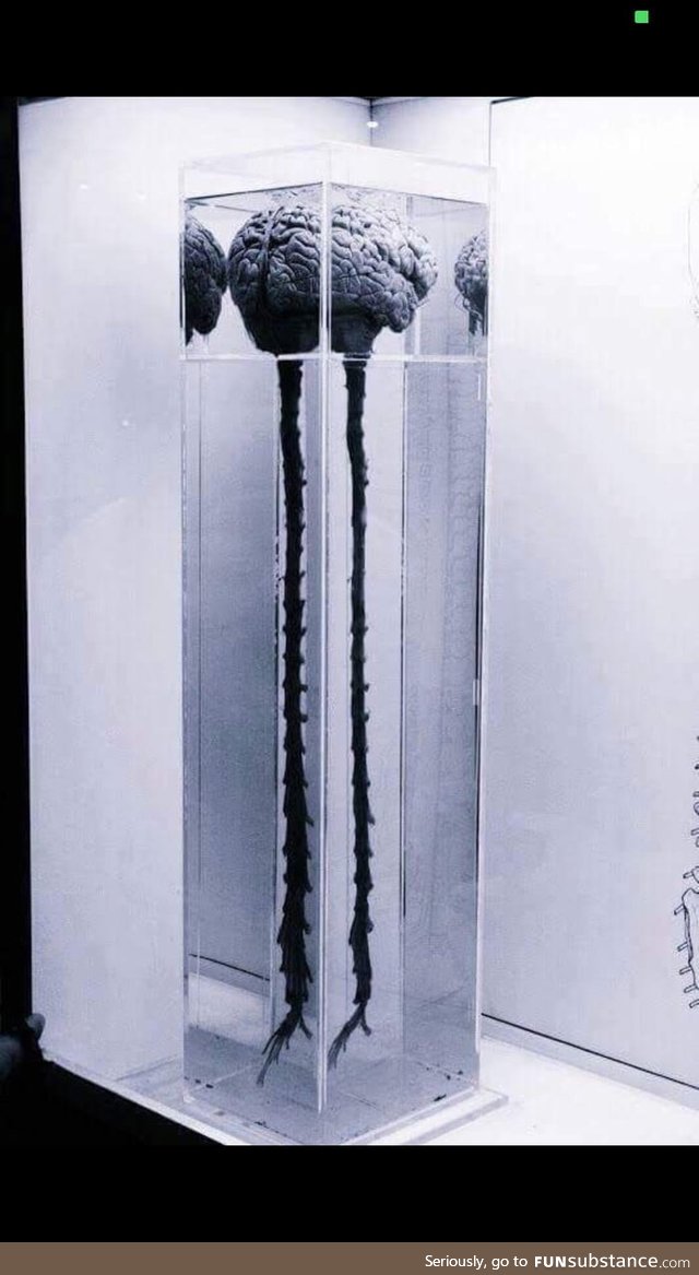 Brain and Spinal cord in a glass box