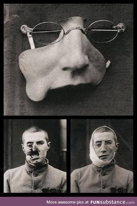 A facial prothesis from World War 1, not as good as plastic surgery but still much better