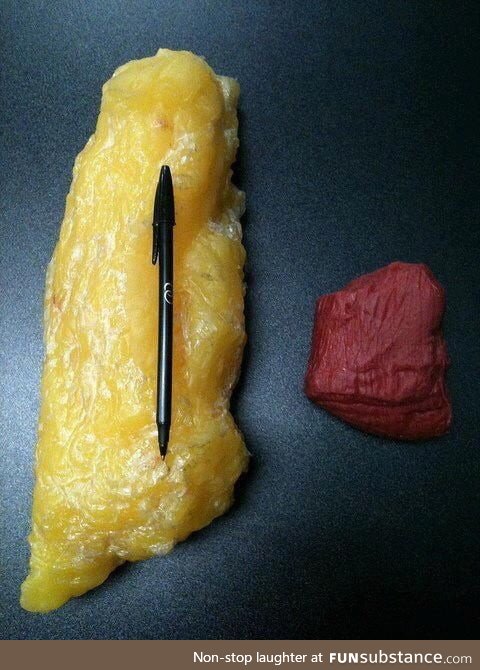 The difference between 1 kg fat and 1 kg muscle