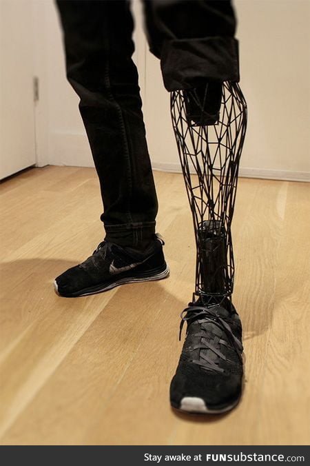 3D printed prosthetic