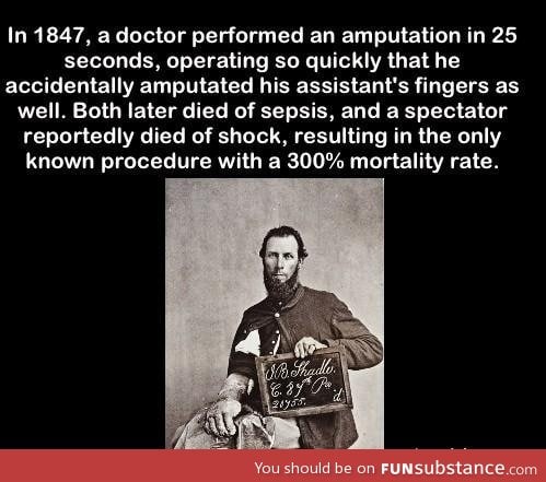 Robert Liston performed a operation with a 300% mortality rate