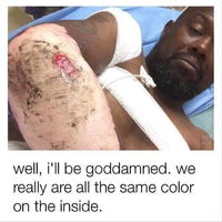 Everyone are good inside