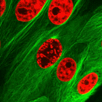 Epithelial cell undergoing mitosis