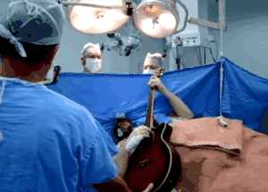 Patient sings and plays guitar while undergoing a brain surgery