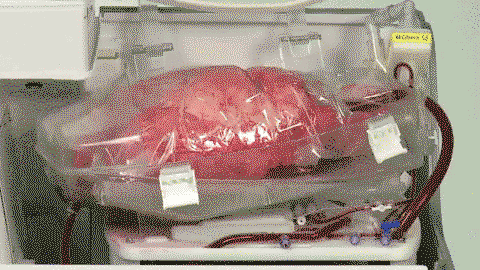 Lung in a box - the system is used to keep organs healthy during transport