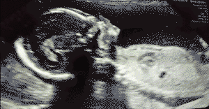 My baby's ultrasound was fascinating (18 weeks)