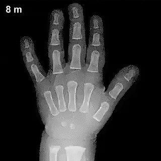 This is how the bones grow and form in your hand