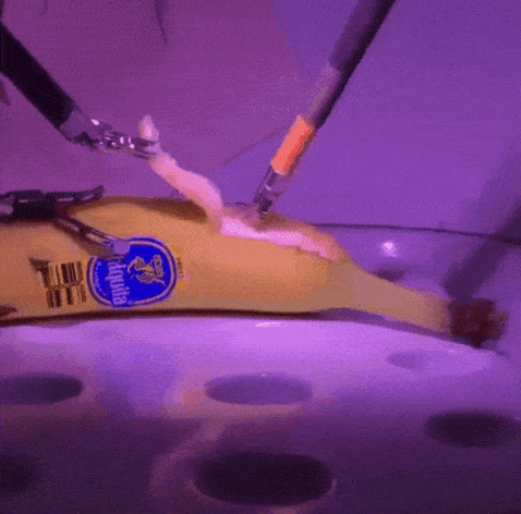 Weird Wednesday - They Did Surgery on a Banana