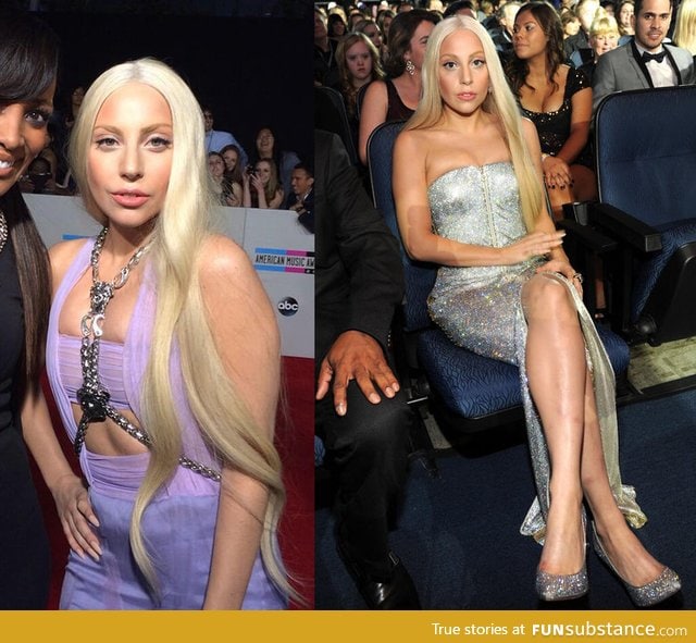 So lady gaga decided to dress normal