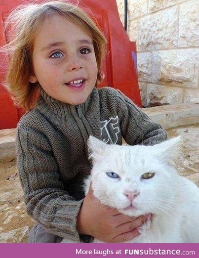 Israeli boy and his cat have matchingeye