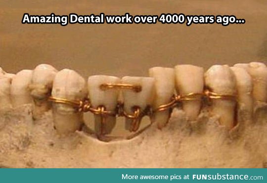 Vintage dental work
