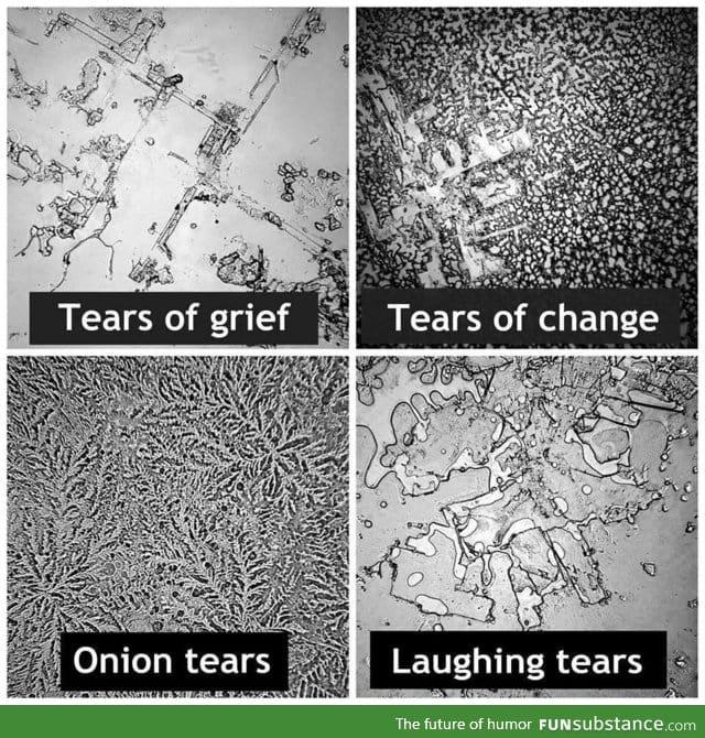 Tears under a microscope