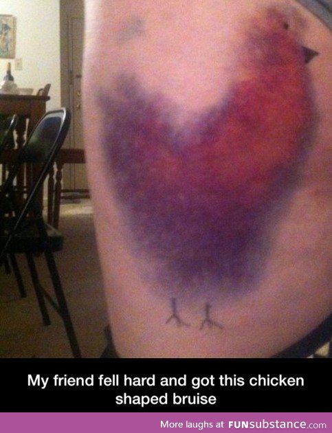 Chick bruise