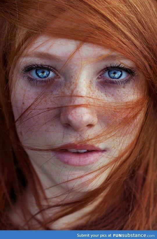 The beauty of freckles