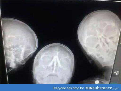 When radiologists take a selfie