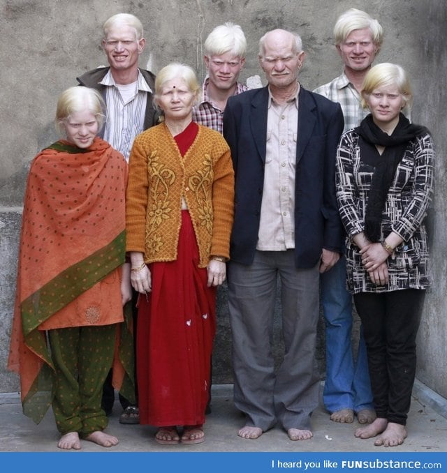 Albino Family from India