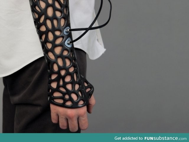 3D printed cast with ultrasound to heal bones faster