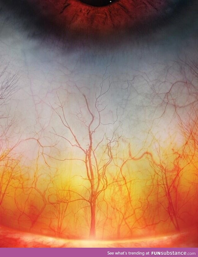 The human eye up close looks like a spooky forest