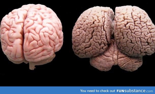 A human brain on the left, a dolphin brain on the right