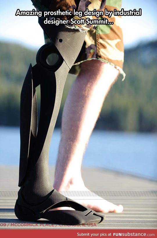 Beautiful prosthetic leg
