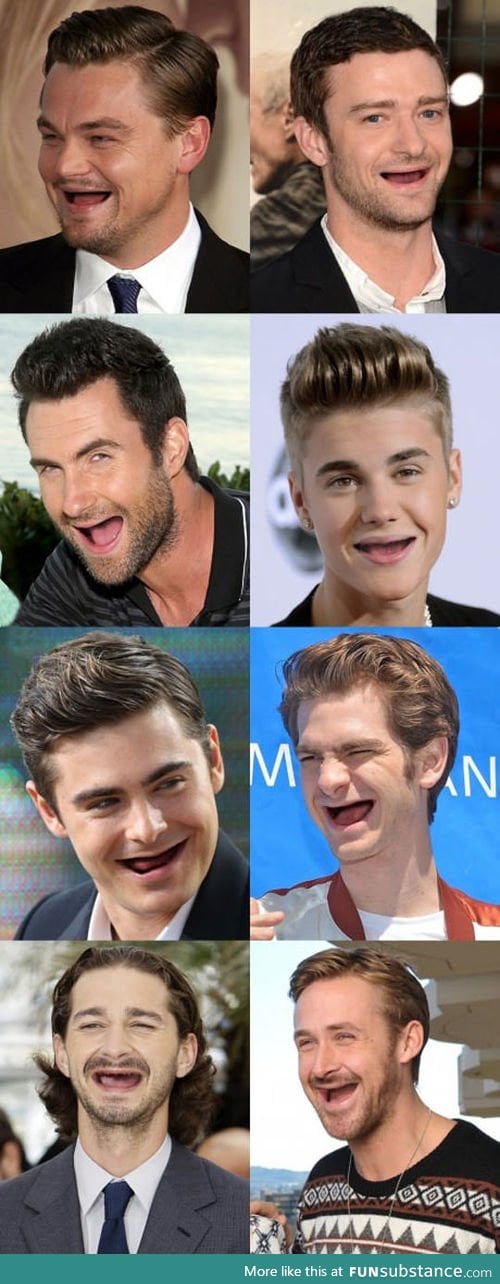 When celebrities don't have teeth, you should take care of them