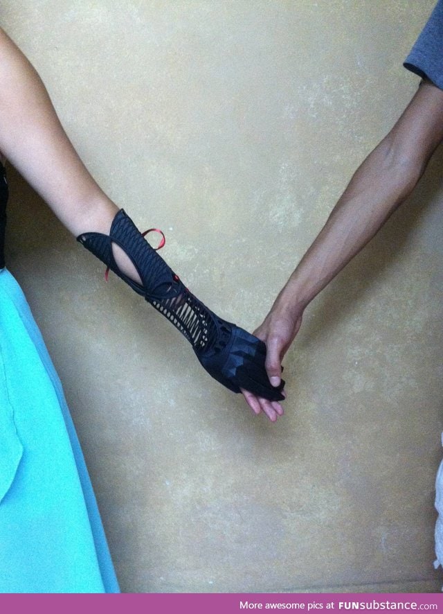 Someone made a prosthetic arm for his friend