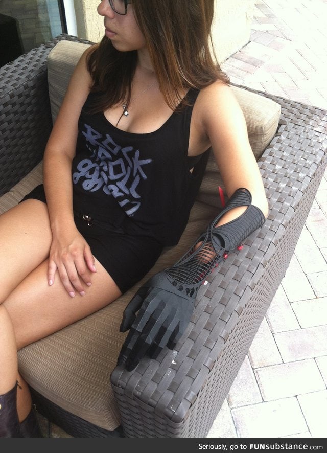 3D printed Prosthetic arm