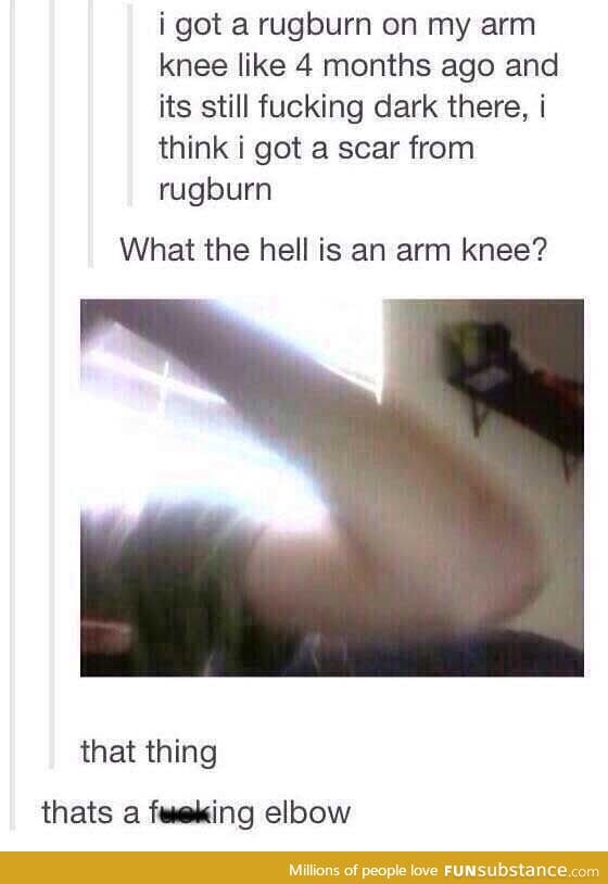 I hurt my arm knee :(