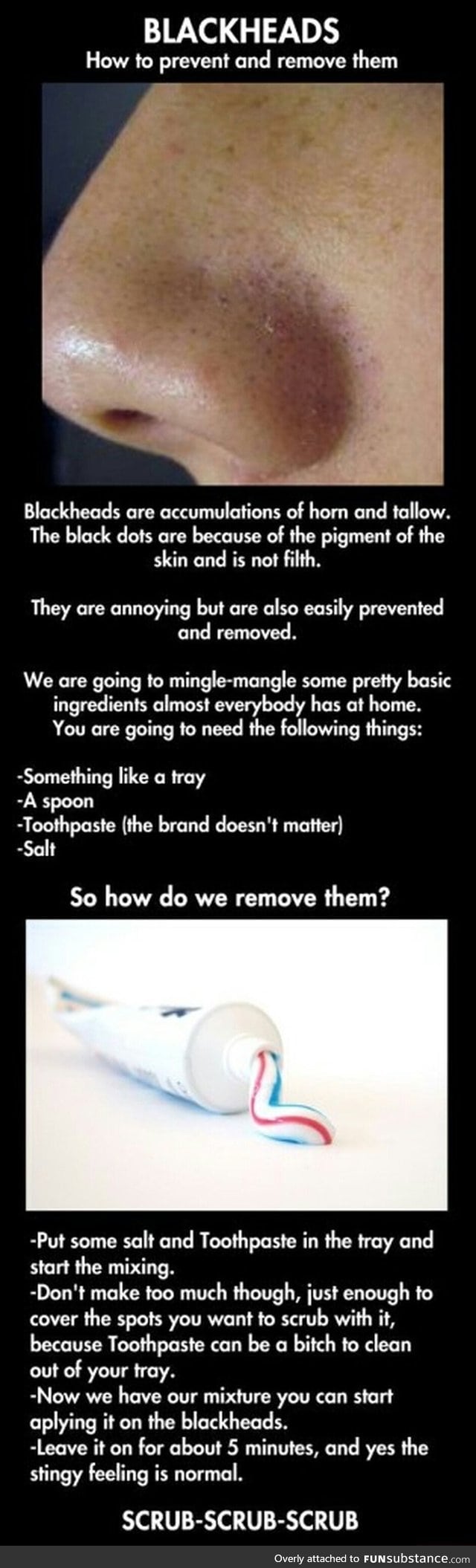 How to remove blackheads