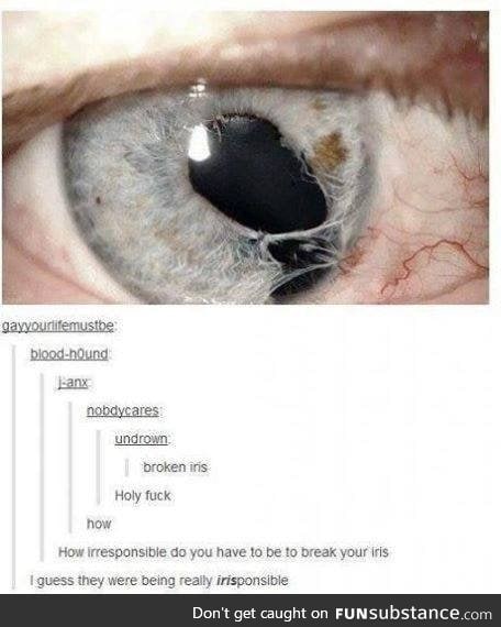 Broken iris