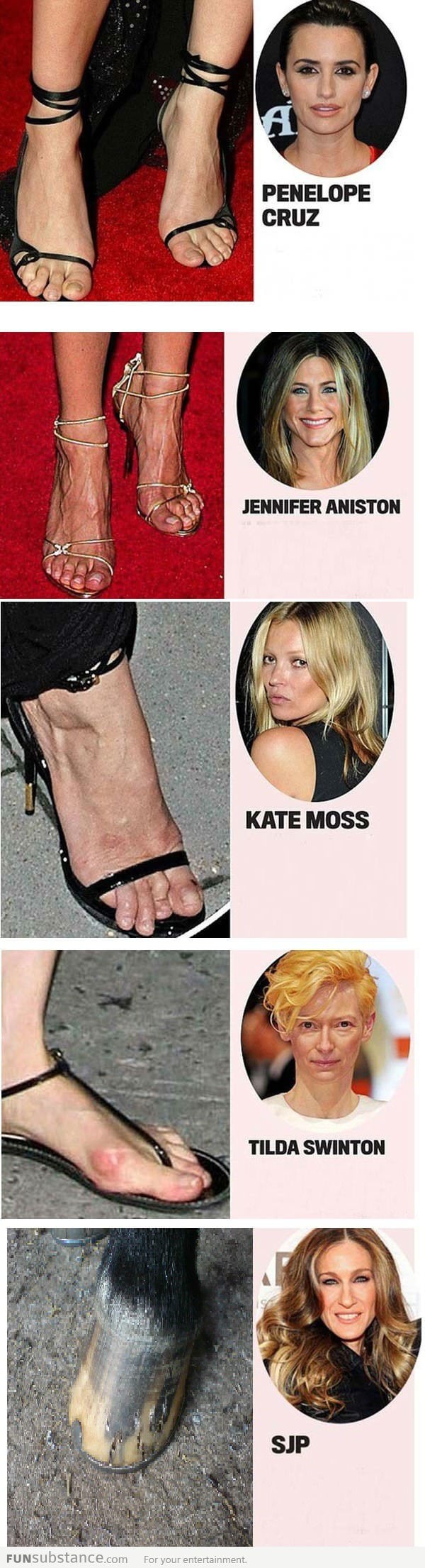 Gross celebrity feet