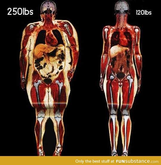 Body Scans: Fat vs Fit.