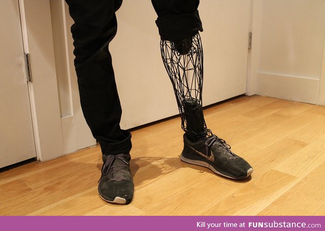 3D printed prosthesis
