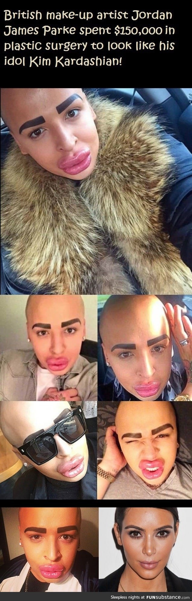 Guy spends $150,000 in plastic surgery to look like Kim Kardashian